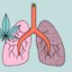 Estudio sobre el efecto del cannabis y el tabaco en el pulmón