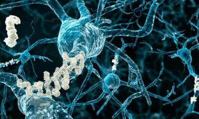 CBD para la memoria y el Alzheimer