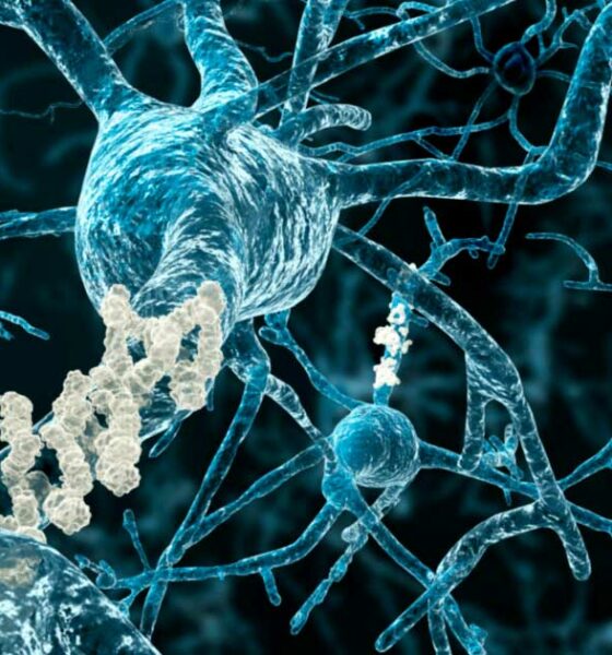 CBD para la memoria y el Alzheimer