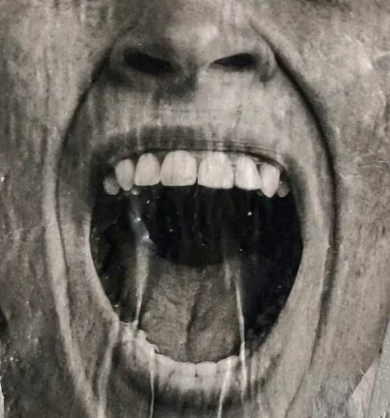 Riesgo de cáncer oral y cannabis