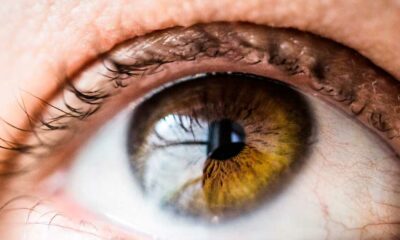 El CBD y el tratamiento de la inflamación ocular